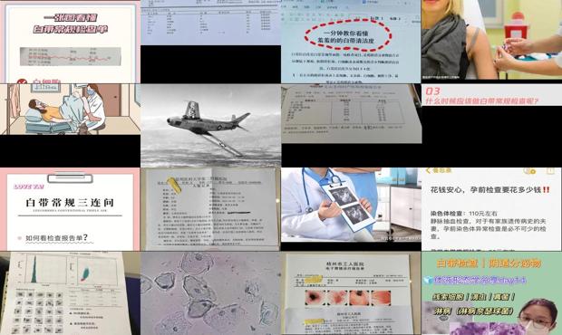 汕头白带常规检查多少钱