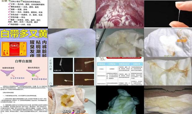 汕头白带多有异味是什么原因引起的