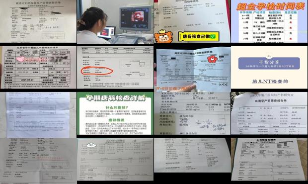 汕头什么是唐筛检查