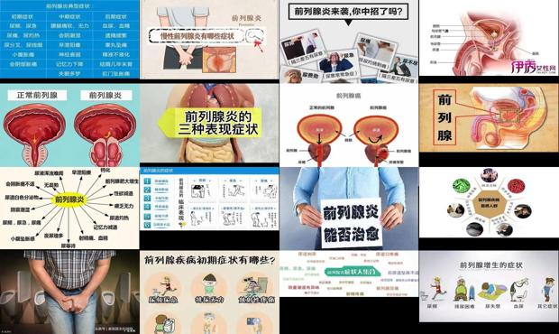 汕头男人前列腺有什么症状表现