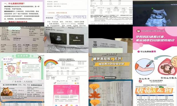汕头什么时候做唐筛
