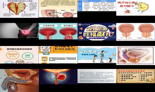 汕头前列腺影响性功能吗