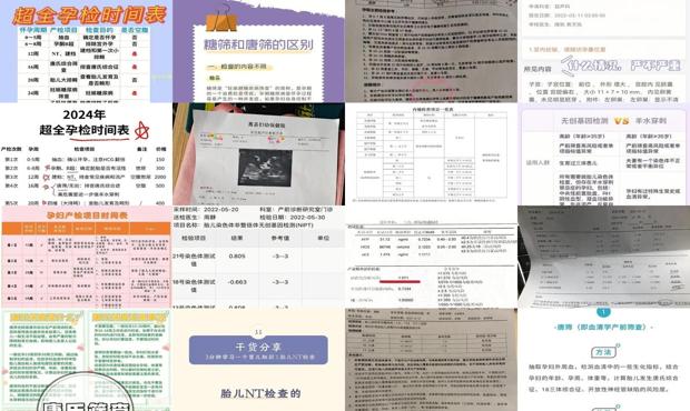 汕头唐筛主要检查什么项目多少钱