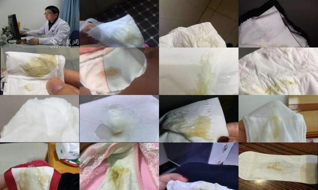 汕头怀孕白带发黄怎么回事