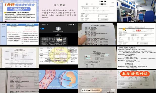 汕头唐筛查多少钱