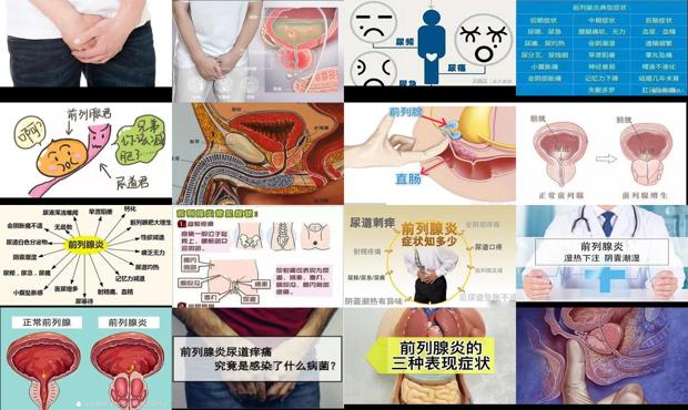 汕头得了前列腺是什么症状