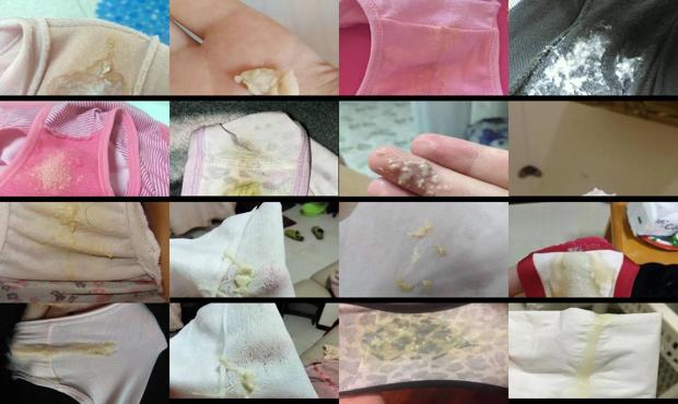 汕头白带豆腐渣状