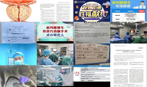 汕头前列腺手术价格