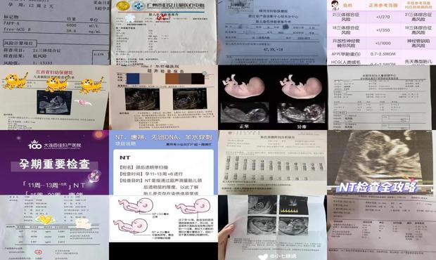 汕头nt跟唐筛有什么区别