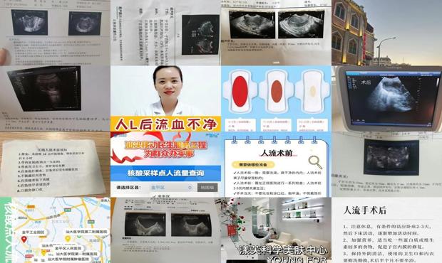 汕头怎样判断人流是否干净