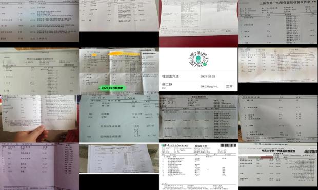 汕头不孕不育激素检查