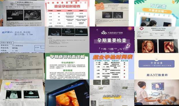 汕头孕妇检查nt和唐筛哪个好