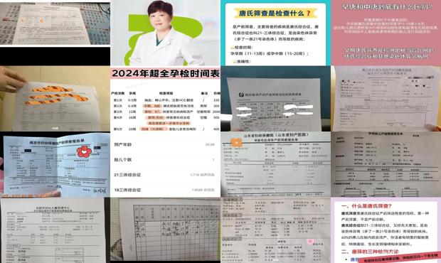 汕头中期唐筛需要空腹吗