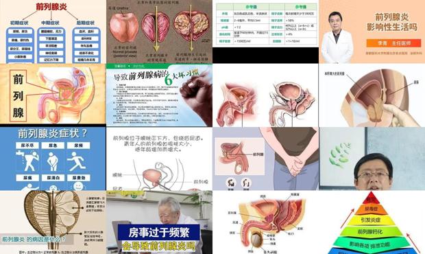 汕头前列腺炎会导致早射吗