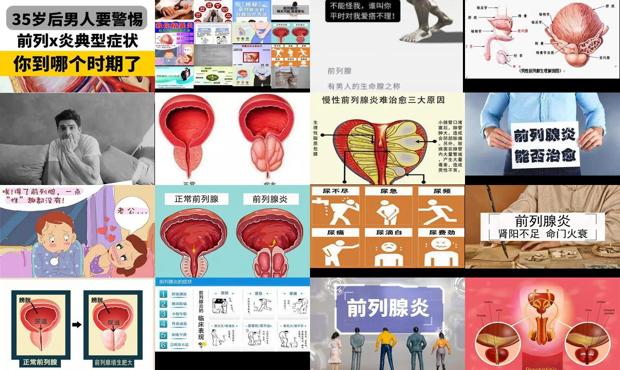 汕头前列腺炎不治疗有什么后果