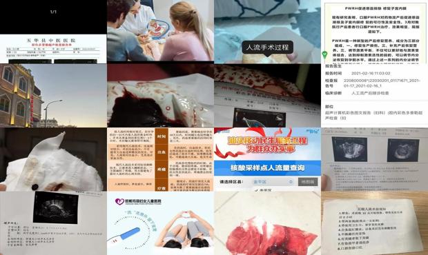 汕头人流怎么判断没流干净