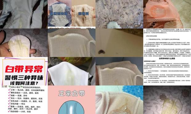 汕头白带有异味是什么引起的