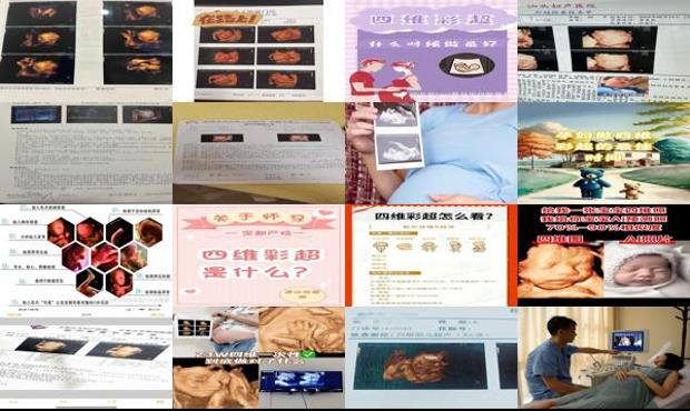 汕头四维什么时候做是*佳时间