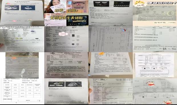 汕头16周做唐筛多少钱