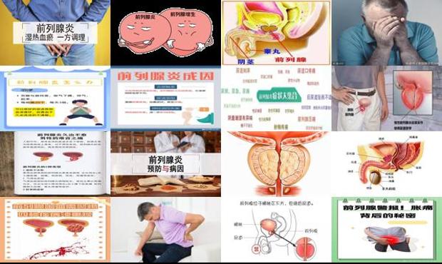 汕头男性前列腺炎症状