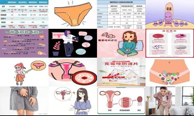 汕头外阴阴道性不孕