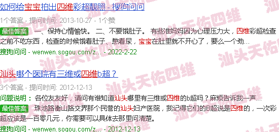 汕头宝宝四维照