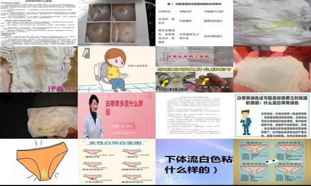 汕头白带过多是什么原因造成的