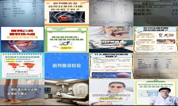 汕头前列腺液检查很疼吗