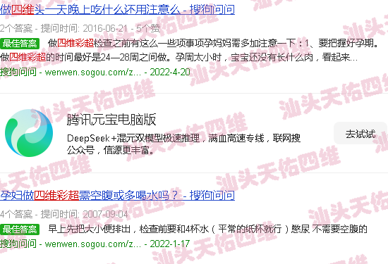 汕头四维彩超前的准备