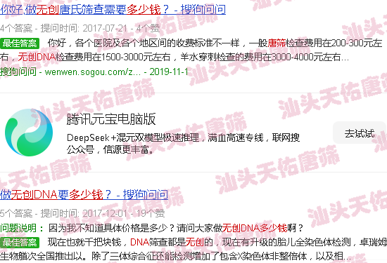 汕头唐筛*dna多少钱