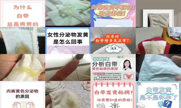 汕头白带是黄色的正常吗