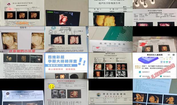 汕头四维要预约吗