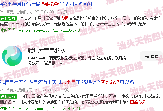 汕头孕妇六个月四维彩超