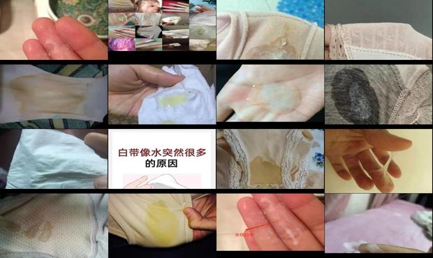 汕头白带突然像水一样流出