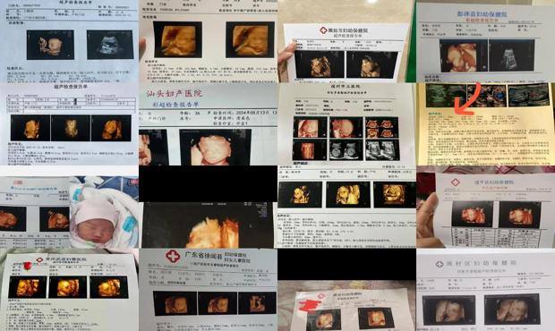 汕头四维*是彩超吗