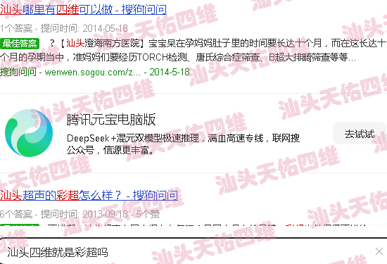 汕头四维*是彩超吗